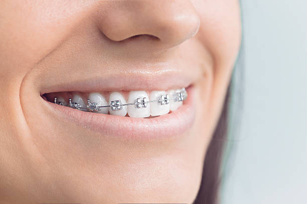 Best Traditional Braces  in Tawas City, MI